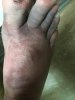 foot.jpg