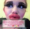 antivaxxer silicon lips.jpg